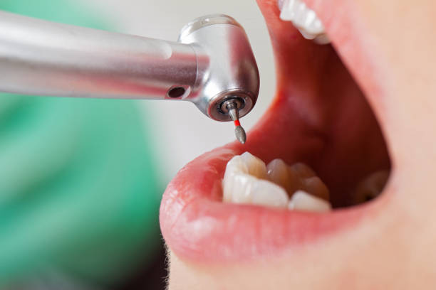 Best Tooth Pain Emergency Relief  in Weissport East, PA